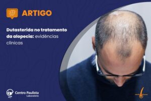 Dutasterida no tratamento da alopecia: evidências clínicas