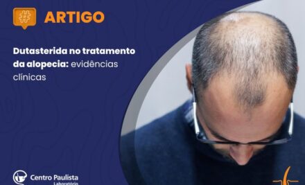 Dutasterida no tratamento da alopecia: evidências clínicas