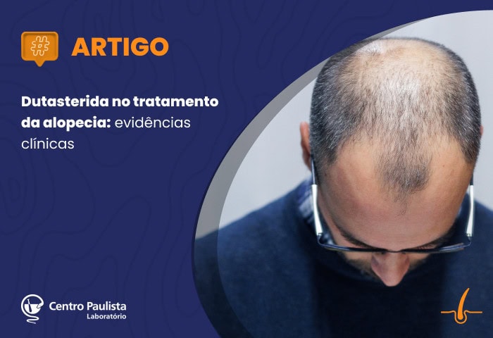 Dutasterida no tratamento da alopecia: evidências clínicas