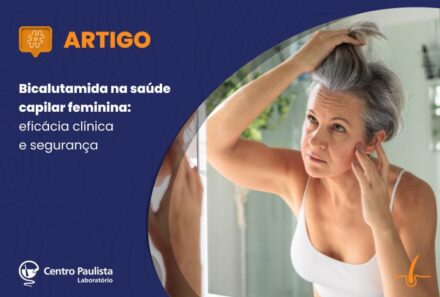 Bicalutamida na saúde capilar feminina: eficácia clínica e segurança