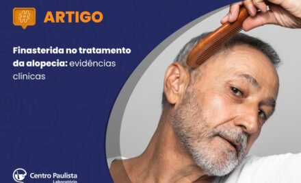 Finasterida no tratamento da alopecia: eficácia clínica