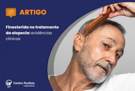Finasterida no tratamento da alopecia: eficácia clínica