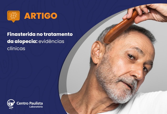 Finasterida no tratamento da alopecia: eficácia clínica