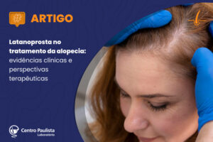 Latanoprosta no tratamento da alopecia: evidências clínicas e perspectivas terapêuticas