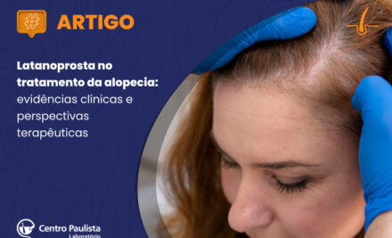 Latanoprosta no tratamento da alopecia: evidências clínicas e perspectivas terapêuticas