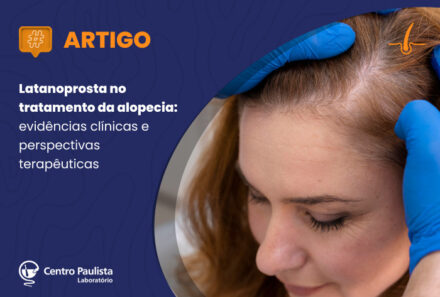 Latanoprosta no tratamento da alopecia: evidências clínicas e perspectivas terapêuticas