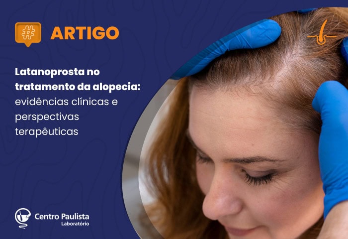 Latanoprosta no tratamento da alopecia: evidências clínicas e perspectivas terapêuticas