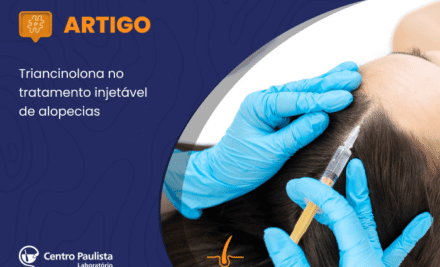 Título: Triancinolona no tratamento injetável de alopecias