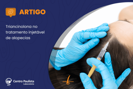 Título: Triancinolona no tratamento injetável de alopecias