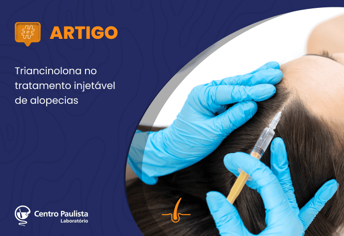 Título: Triancinolona no tratamento injetável de alopecias