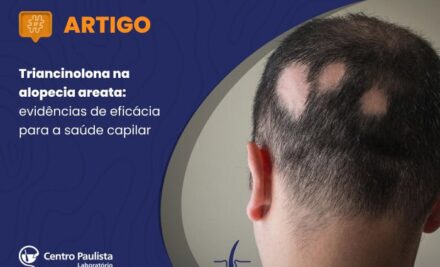 Triancinolona na alopecia areata: evidências de eficácia para a saúde capilar