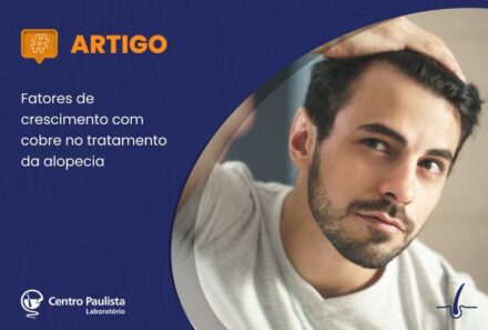 Fatores de crescimento com cobre no tratamento da alopecia