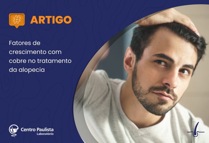 Fatores de crescimento com cobre no tratamento da alopecia